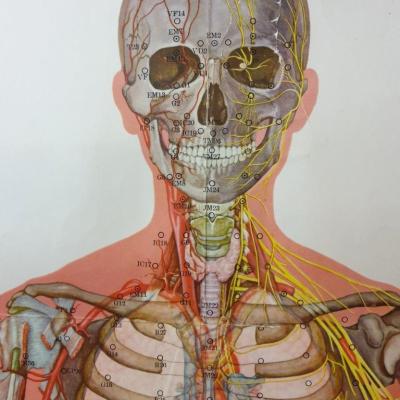 0 affiche acupuncture 2