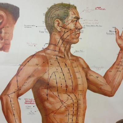 0 affiche acupuncture 5