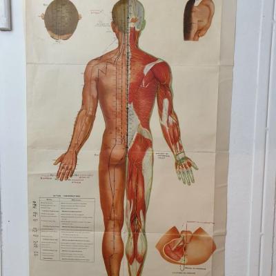 1 affiche acupuncture 3