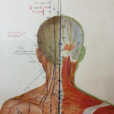2 affiche acupuncture 3