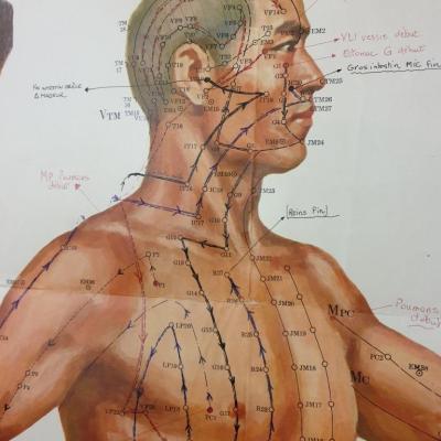2 affiche acupuncture 5