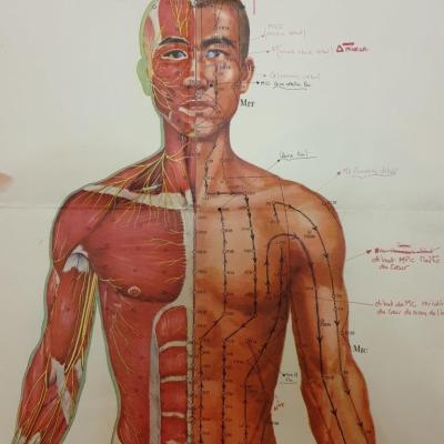 2 affiche acupuncture n 1
