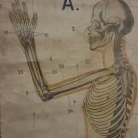 3 affiche ecorche entoile
